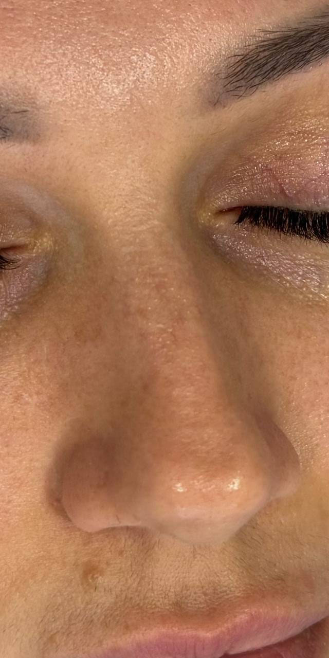 Before image