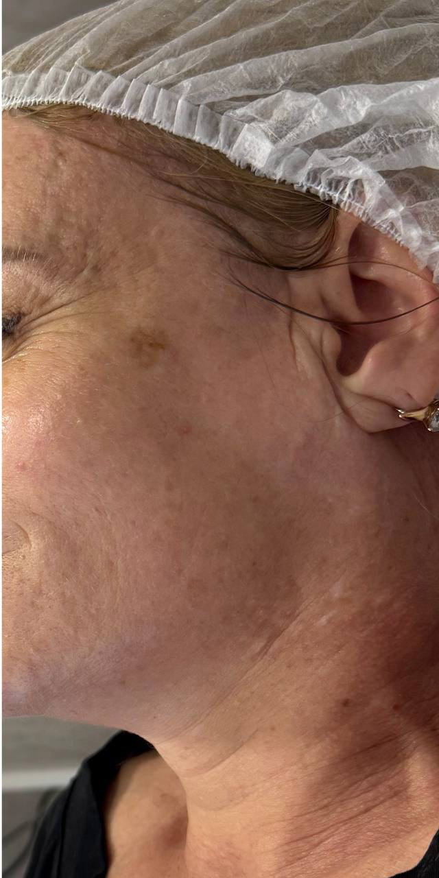 After image