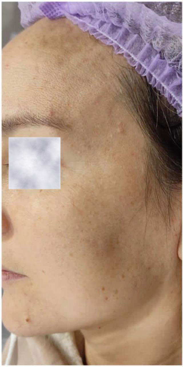 Before image
