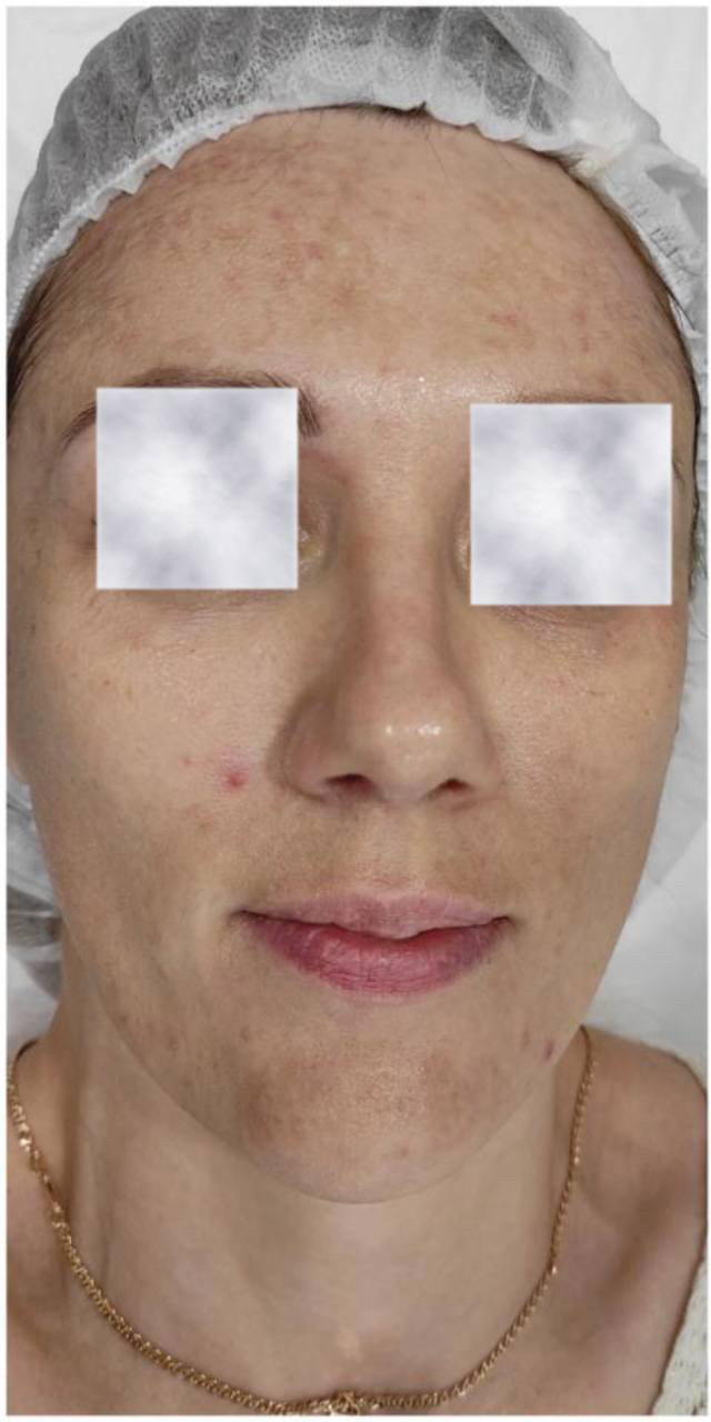 Before image